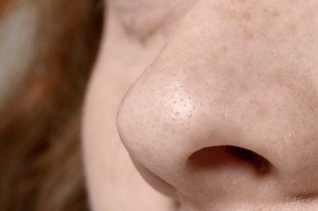 Сыпь на коже: причины и методы лечения
