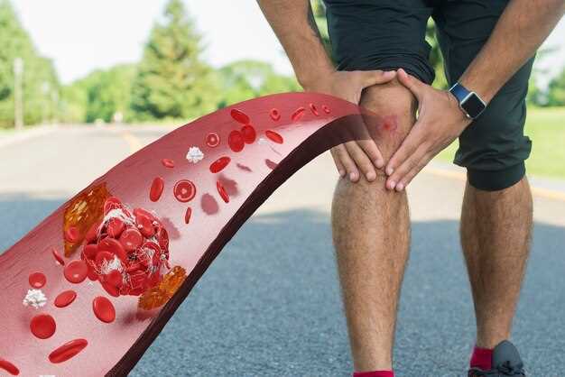 Медикаментозное лечение артроза коленного сустава: какие препараты помогут справиться с болезнью?
