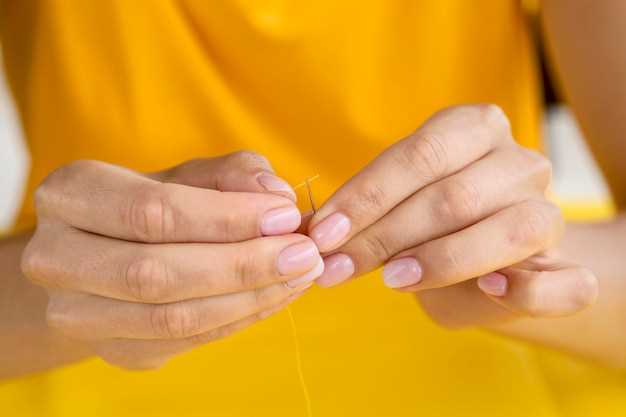 Продольные полосы на ногтях рук у женщин: причины и методы лечения