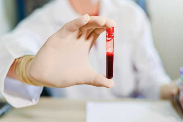 Общий анализ крови: значения и интерпретация результатов