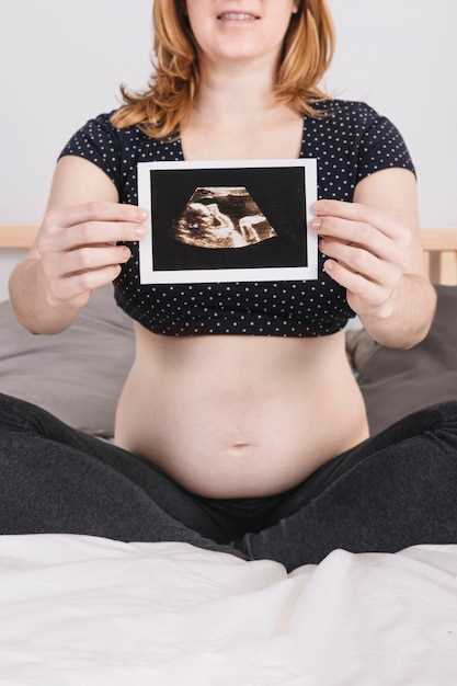 Факторы риска развития внематочной беременности