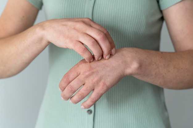 Причины возникновения дерматита на руках и его симптомы