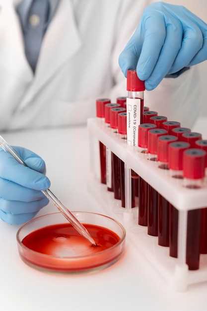 Обозначение гемоглобина и его единицы измерения в общем анализе крови