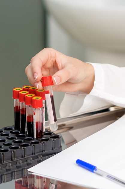 Какие результаты показывает анализ крови натощак и после приема пищи?