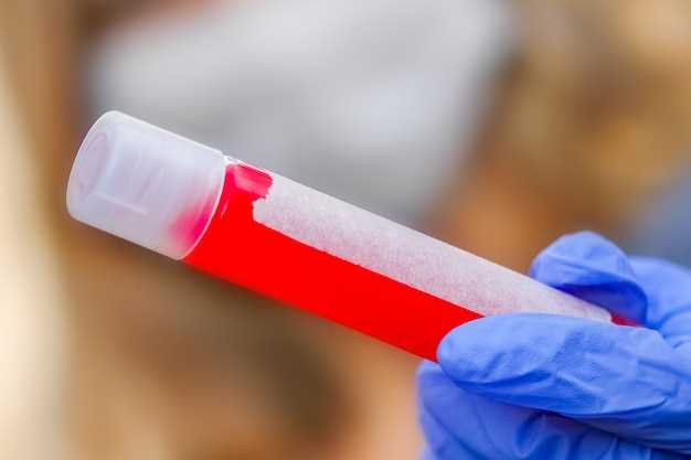 Домашний тест на гемоглобин: простые и надежные способы