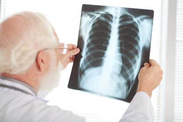 Описание рентгенологического изображения туберкулеза легких