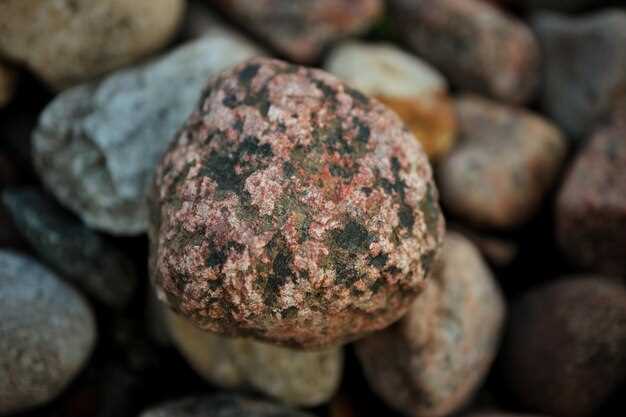 Камни в почках: общая информация