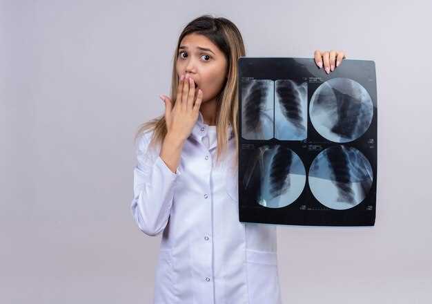 Заголовок 2: Особенности рентгеновских снимков при пневмонии