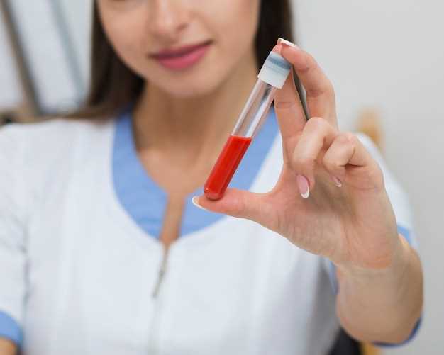 Средний объем тромбоцитов - ключевой показатель всего кровеносной системы