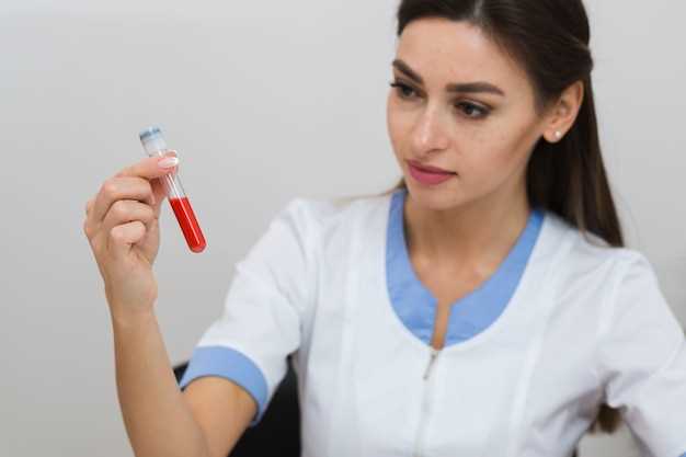 Как правильно подготовиться к общему анализу крови?