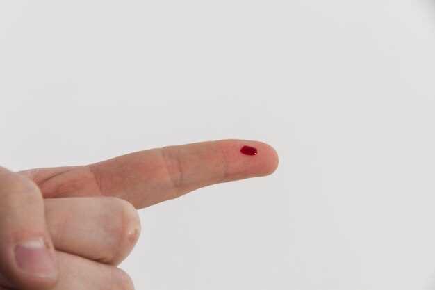 Кровь при порезах: почему сворачивается плохо?